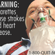 Image for article titled All the Disgusting Pictures the FDA Is Going to Put on Cigarette Boxes